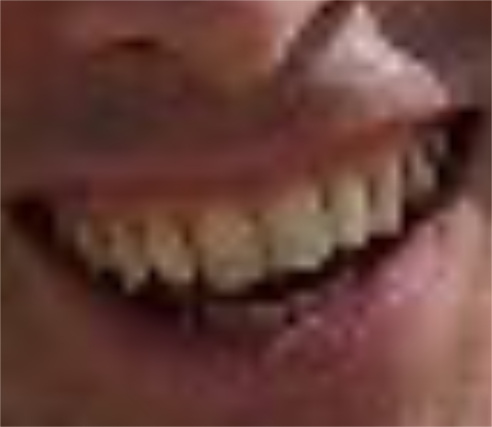 Sebastian Smith teeth