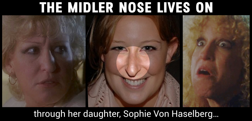 Midler nose lives on